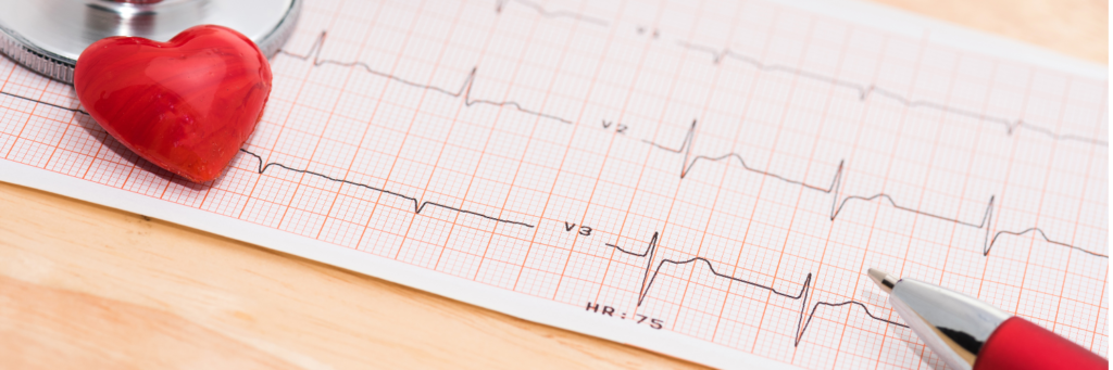 how-to-read-an-ecg-or-ekg-incredible-health